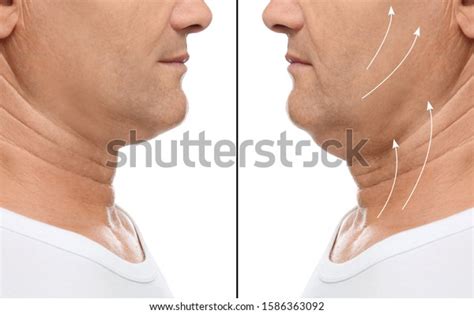 Sagging Skin Men Over Royalty Free Licensable Stock Photos