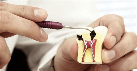 Endodontia Em Santo Andr Na Rubi Odonto Agende Sua Avalia O