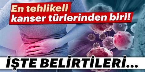 Kanser Nedir Belirtileri Nelerdir Kanser Türleri Nelerdir Kanser