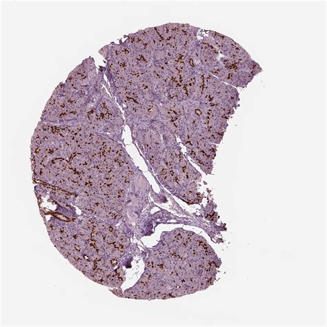 Tissue expression of SOX9 - Staining in pancreas - The Human Protein Atlas 