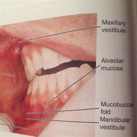 Vestibules Of Oral Cavity With It S Landmarks Diagram Quizlet