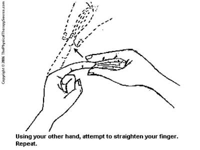 Hand Exercises from ThePhysicalTherapySource.com: Hand - Finger ...