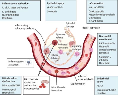 Acute Respiratory Distress Syndrome In Adults Diagnosis Outcomes