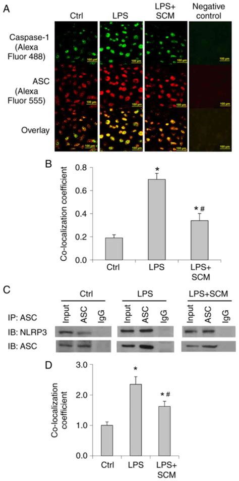 Inhibition Of LPSinduced NLRP3 Inflammasome Activation By Stem Cell