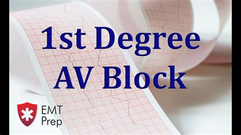 1st Degree Heart Block Ecg Findings - Photos Idea