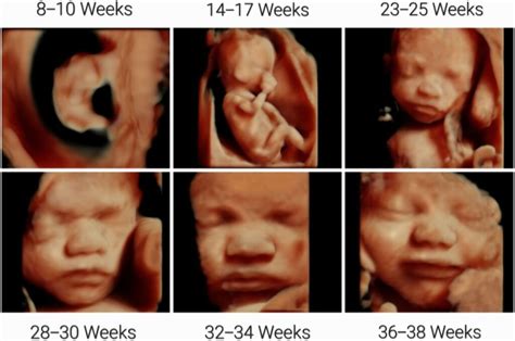 3d4d 5d Hd Ultrasound Packages Early Gender