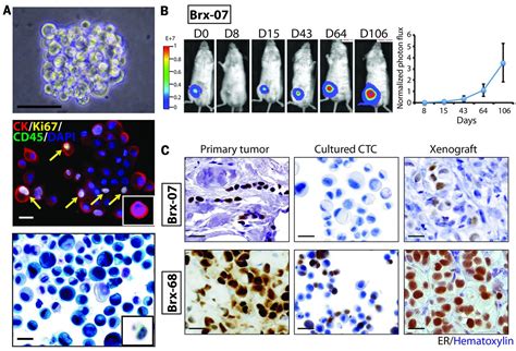 Ex Vivo Culture Of Circulating Breast Tumor Cells For Individualized