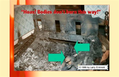 Spontaneous Human Combustion Normal Paranormal