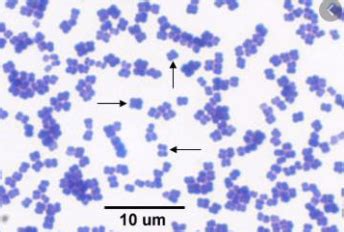 Microbiology Lab Final Exam Flashcards Quizlet