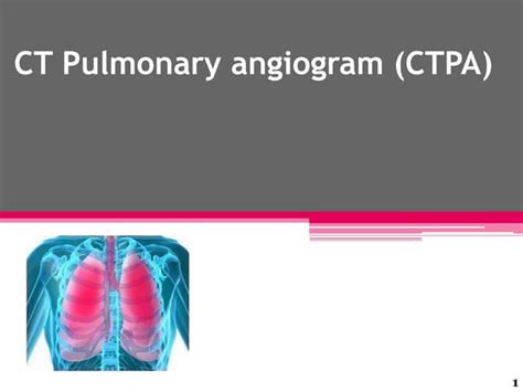 Ct Pulmonary Angiogram Ctpa Ppt