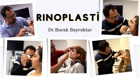 Rinoplast Sonrasi Tampon Ikarma Dr Burak Bayraktar Youtube