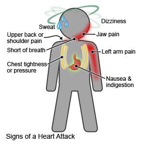 Heart Attack (Discharge Care)