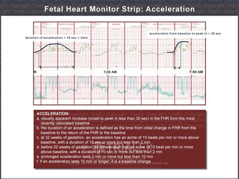 Accelerations Fhr