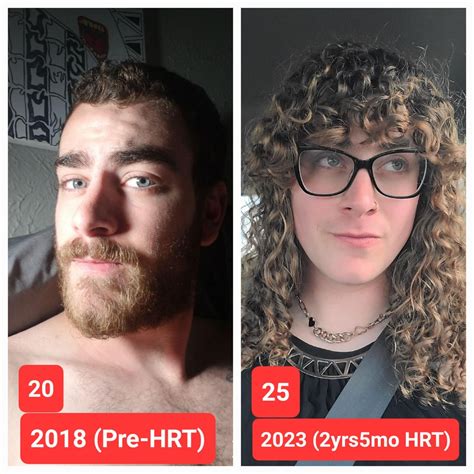 Me At 20 Pre Hrt Vs Me Now At 25 2yrs5mo Hrt R Transtimelines