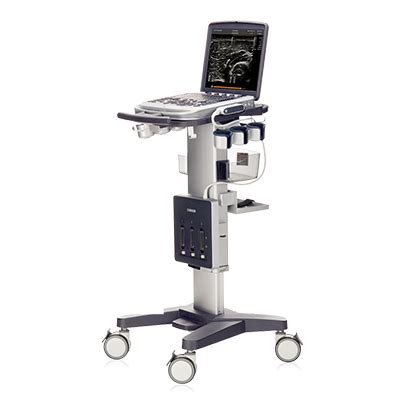 Chison Sonobook Portable Shared Service Ultrasound Med Tech