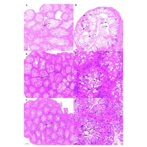 Histological Characteristics In The Hepatopancreas Of Scylla