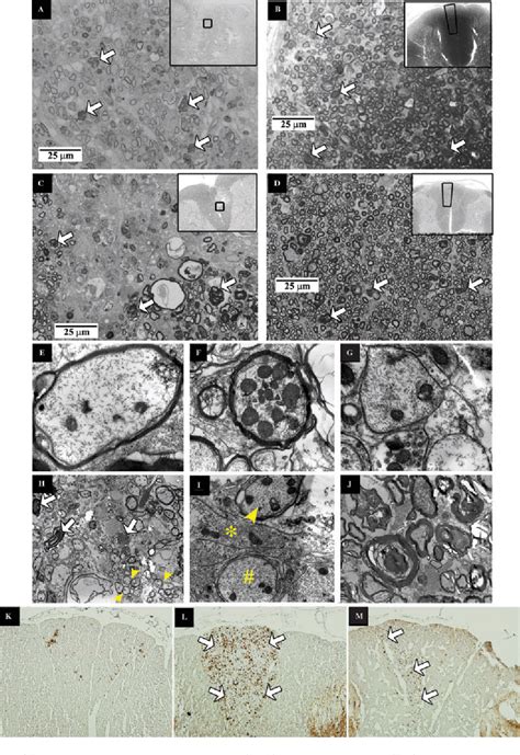 Figure 4 From High Resolution Diffusion Tensor Imaging Of Axonal Damage