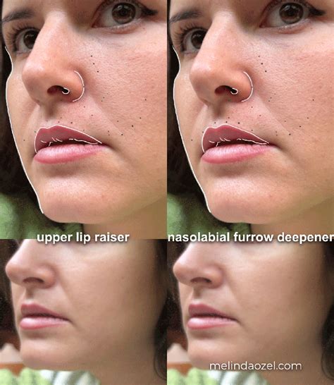 Upper Lip Raiser Vs Nasolabial Furrow Deepener Face The Facs