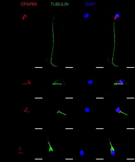 Figure S6 Immunofluorescence Staining Of Cfap65 In The Spermatozoa Download Scientific Diagram