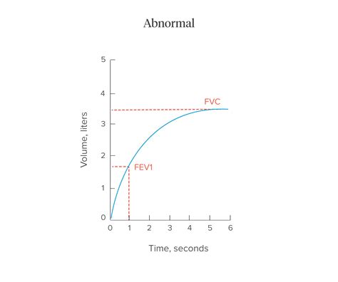 Spirometry: Procedure, “Normal” Values, and Test Results | Normal values, Nursing school notes ...