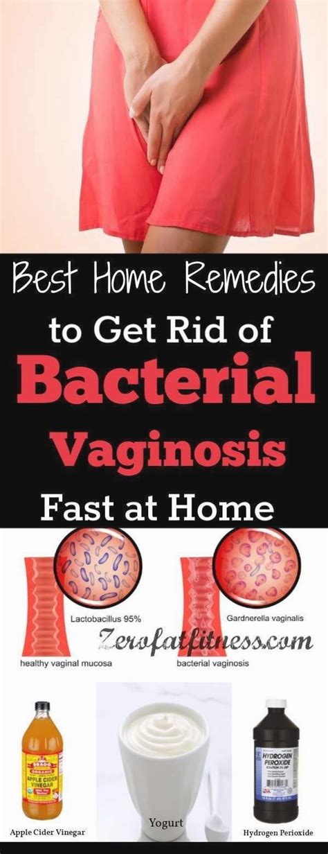 Bacterial Vaginosis Bv How To Cure Bacterial Vaginosis | Hot Sex Picture