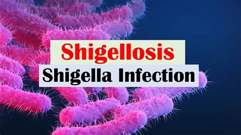 Shigellosis Shigella A Cause Of Bloody Diarrhea Pathophysiology