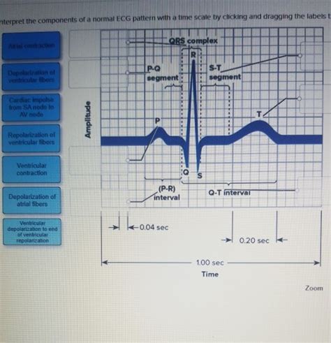 Solved Nterpret The Components Of A Normal Ecg Pattern With