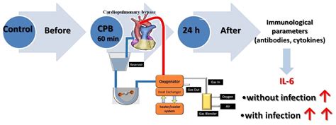 Cardiopulmonary Bypass Diagram