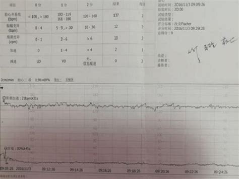 男女宝宝的胎心率对照表分享男孩女孩大不相同 相因网