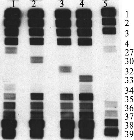 Detection Of Rifampicin Resistance By Reverse Hybridization The