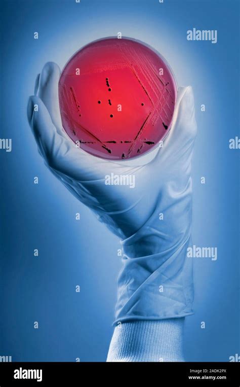 Model Released Salmonella Culture Microbiologist Holding A Petri Dish