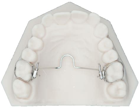 Transpalatal Arch Protec Dental