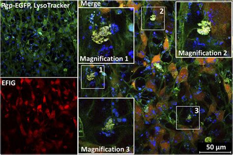 Barrier Bodies Show Lysosomal Staining Lysosomes Of Hcmec D3 Download Scientific Diagram