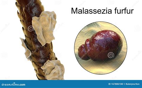 Microscopic Fungi Malassezia Furfur Royalty-Free Illustration | CartoonDealer.com #167893494