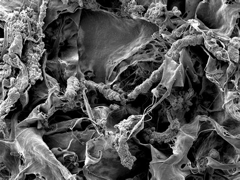 Could manuka honey be effective on collagen scaffolds?