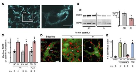 Jci Insight Endothelial Mitochondria Determine Rapid Barrier Failure