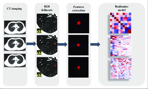 Process Of Radiomics Analysis Download Scientific Diagram