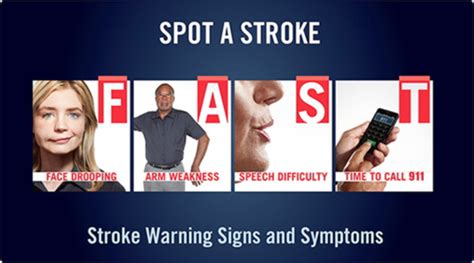 Diagnosis Of Stroke Flashcards Quizlet