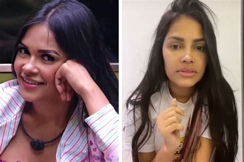 O Antes E Depois Da Cirurgia Da Flay Do Bbb Capricho