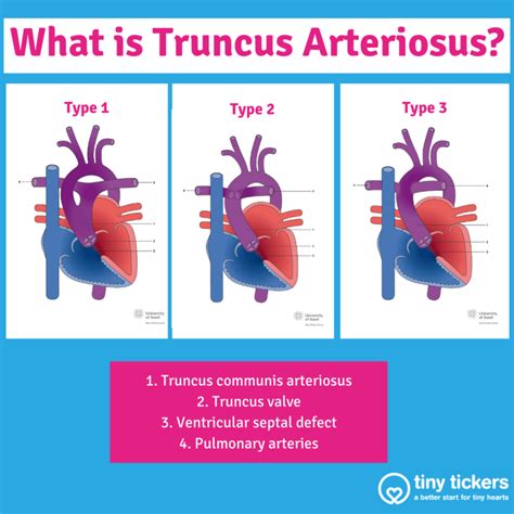 Truncus Arteriosus Tiny Tickers