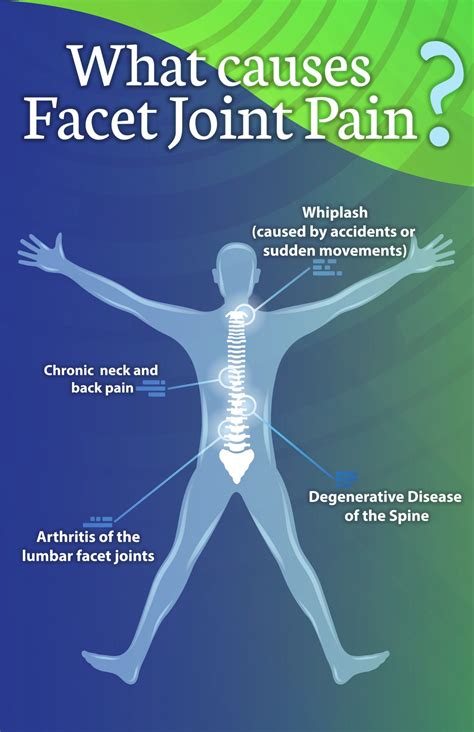 What Makes Facet Joint Pain Worse at Martha Berman blog