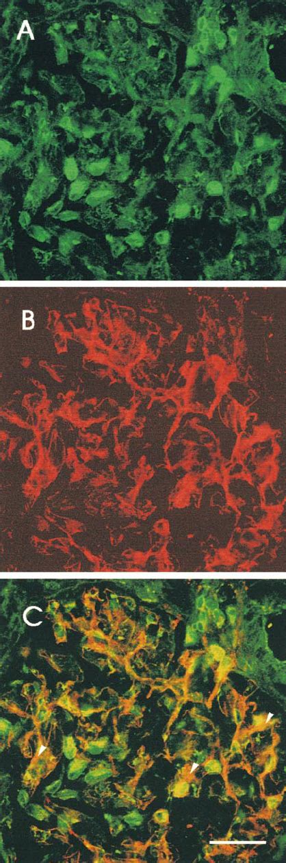 Indirect Immunofluorescence Micrographs Showing A Rat Glomerulus A