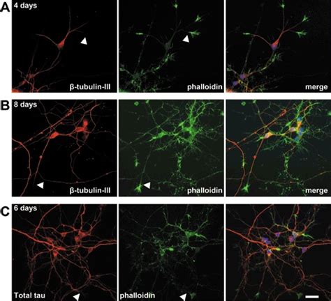Characterization of primary embryonic chick tectal neurons. Labeling ... 