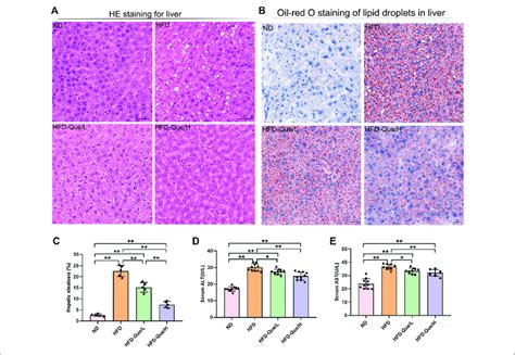 Que Alleviated Lipid Accumulation And Hepatic Injury In Hfd Fed Mice