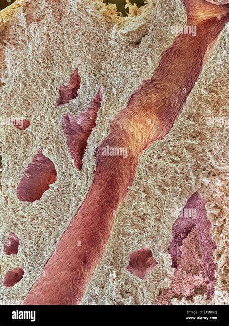 Ovarian Tissue Coloured Scanning Electron Micrograph Sem Of A Section Through The Medulla Of