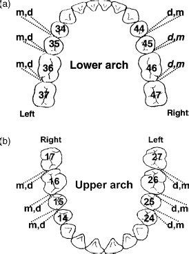 Tooth numbers and surface symbols in the lower arch; (b) tooth numbers ...