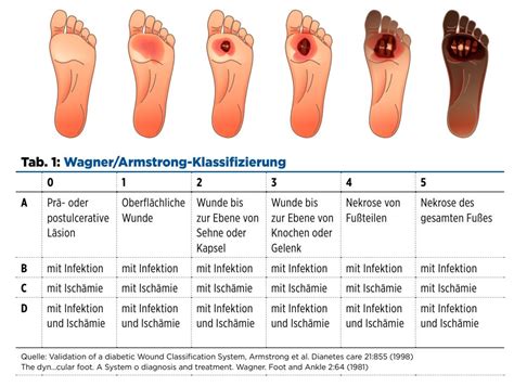 Abrechnung Füße im Fokus Rauchende Köpfe