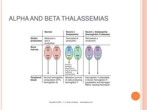 Ppt Hemolytic Anemias Hemoglobinopathies Powerpoint Presentation