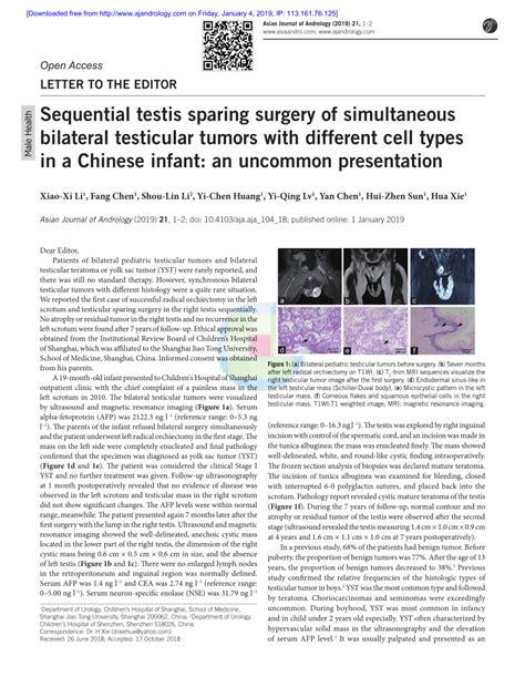 Pdf Sequential Testis Sparing Surgery Of Simultaneous Bilateral Testicular Tumors With