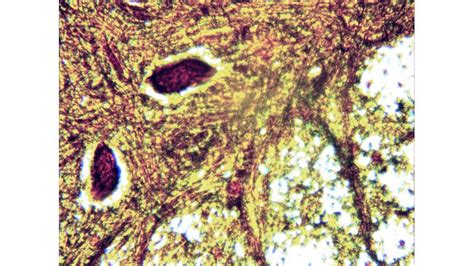 Part Spinal Cord Cross Section For Each Magnification Course Hero